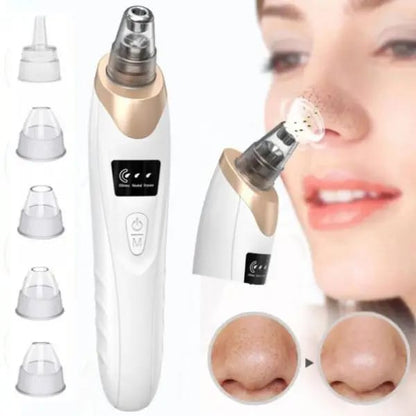 Electric Blackhead Remover & Pore Vacuum