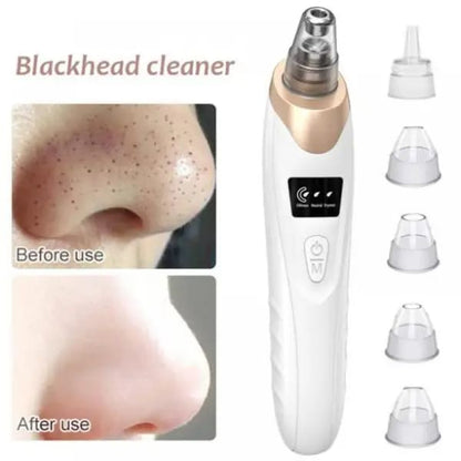 Electric Blackhead Remover & Pore Vacuum